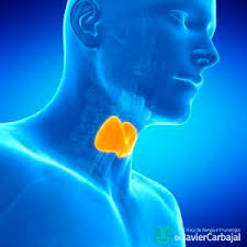 tireoidite de hashimoto