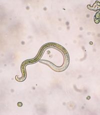 Larva migrans visceral